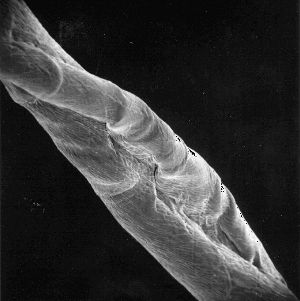 microscopic picture of cotton