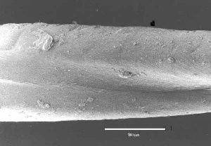 microscopic picture of cotton fiber