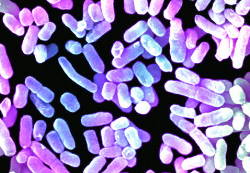 klebsiella pneumoniea